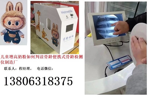 兒童大健康成長奶粉如何判讀骨齡便攜式骨齡檢測儀